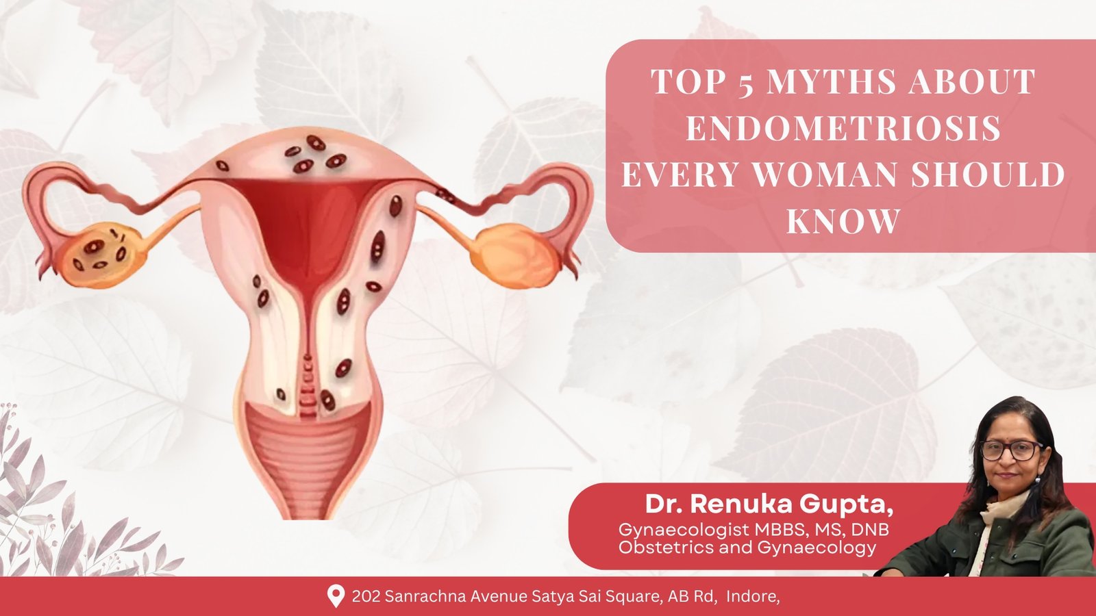 An illustration of the female reproductive system showing endometriosis, with a text overlay discussing the top 5 myths about the condition. Dr. Renuka Gupta, a Gynaecologist, is also featured in the corner of the image.