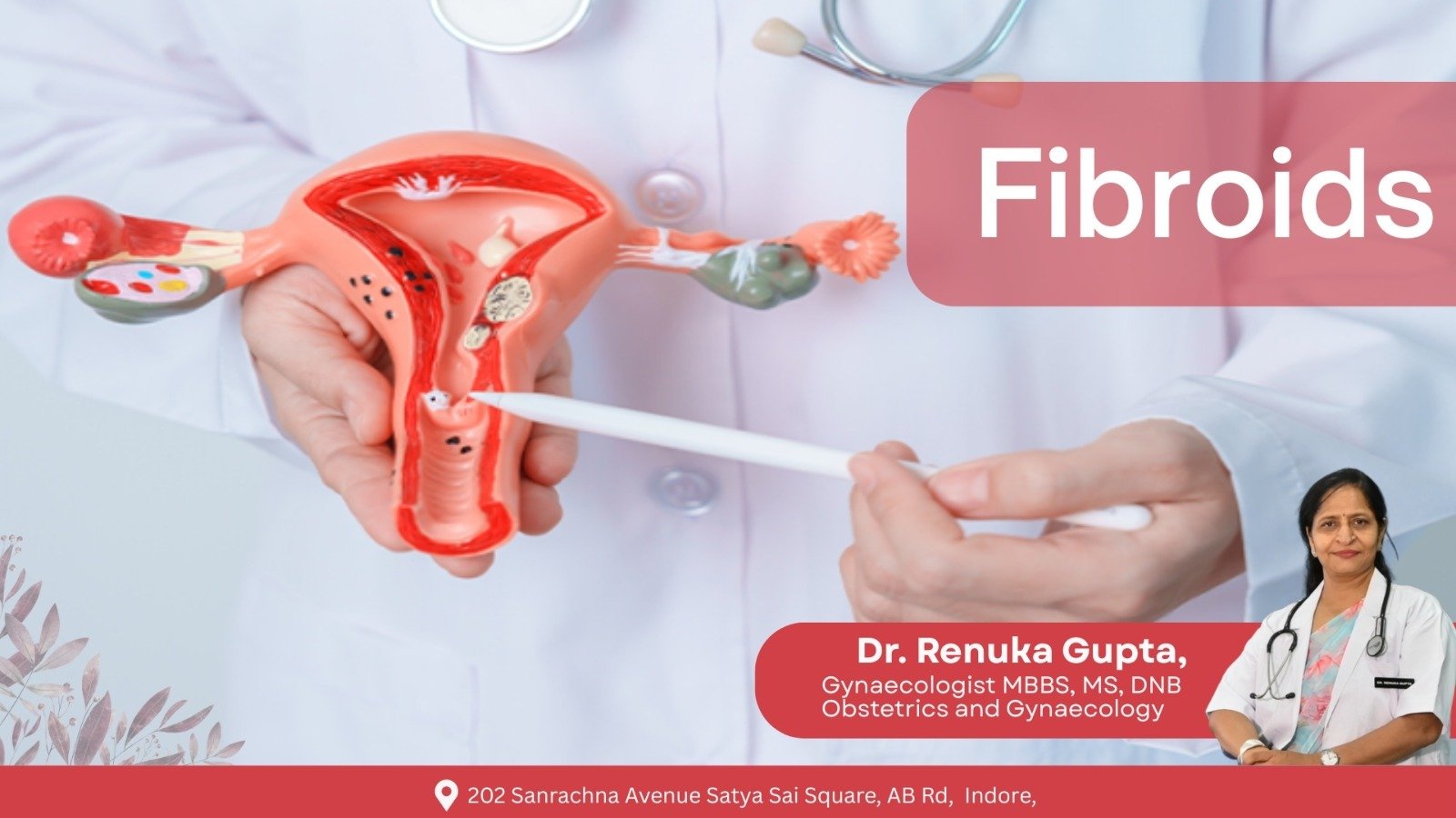 Doctor holding a model of the female reproductive system showing uterine fibroids for patient education.