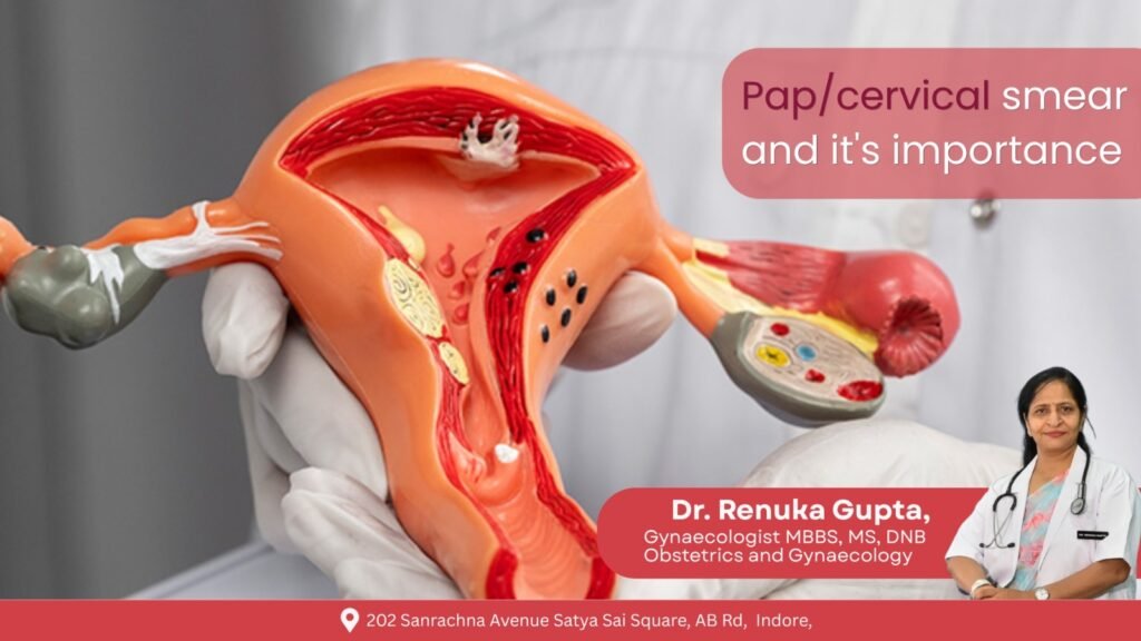 Pap smear test illustration showing cervix model explained by Dr Renuka Gupta Gynecologist in Vijay Nagar Indore for cervical cancer screening awareness