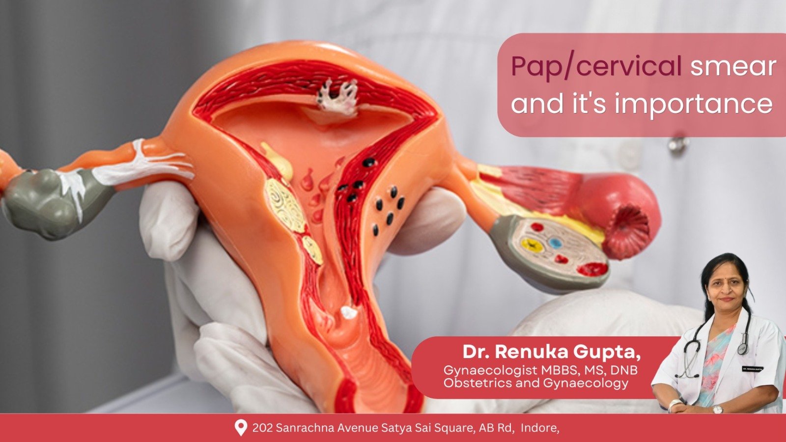Pap smear test illustration showing cervix model explained by Dr Renuka Gupta Gynecologist in Vijay Nagar Indore for cervical cancer screening awareness